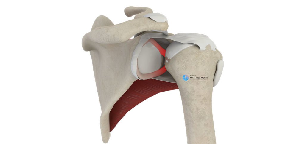 Réinsertion capsulo-labrale