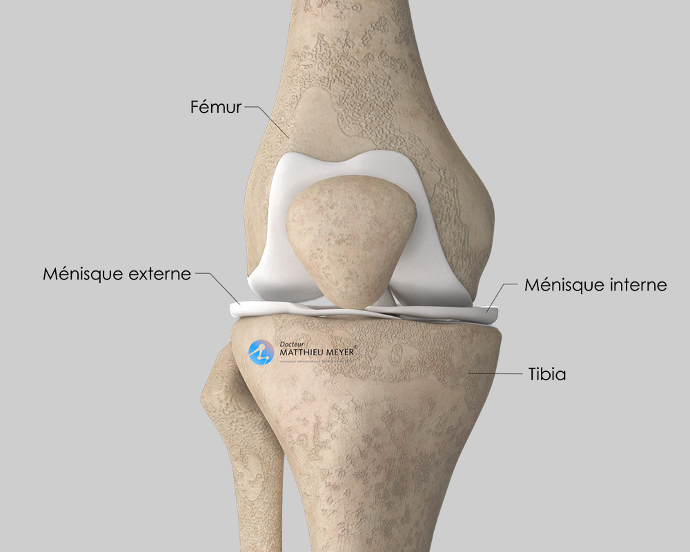 méniscectomie et suture méniscale par arthroscopie - Docteur ...